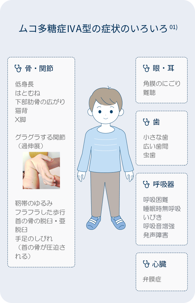 ムコ多糖症 患者さん ご家族の皆様 Biomarin Pharmaceutical Japan ムコ多糖症 患者さん ご家族の皆様 Biomarin Pharmaceutical Japan